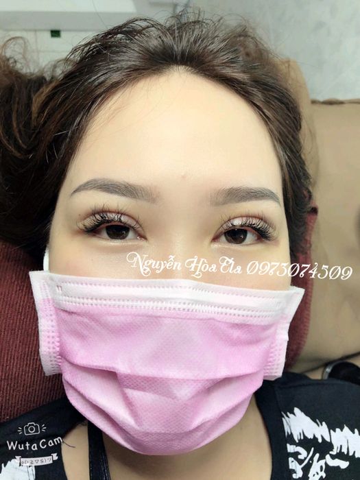 Ảnh 1 Thẩm Mỹ Hòa Ela