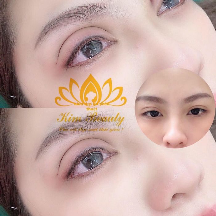 Ảnh 2 Kim Beauty's