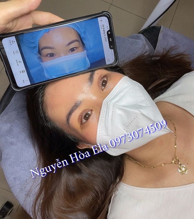 Ảnh 2 Thẩm Mỹ Hòa Ela