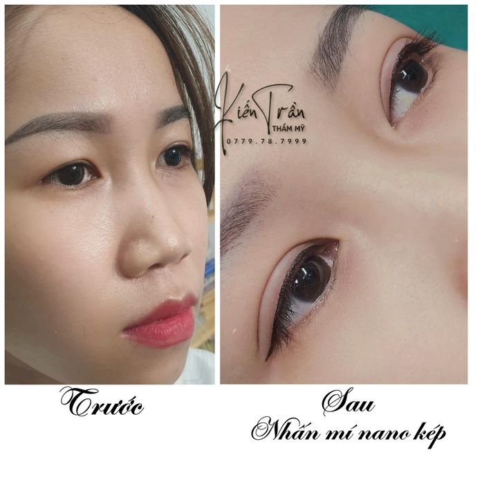 Ảnh 2 Thẩm Mỹ Bối Aesthetics