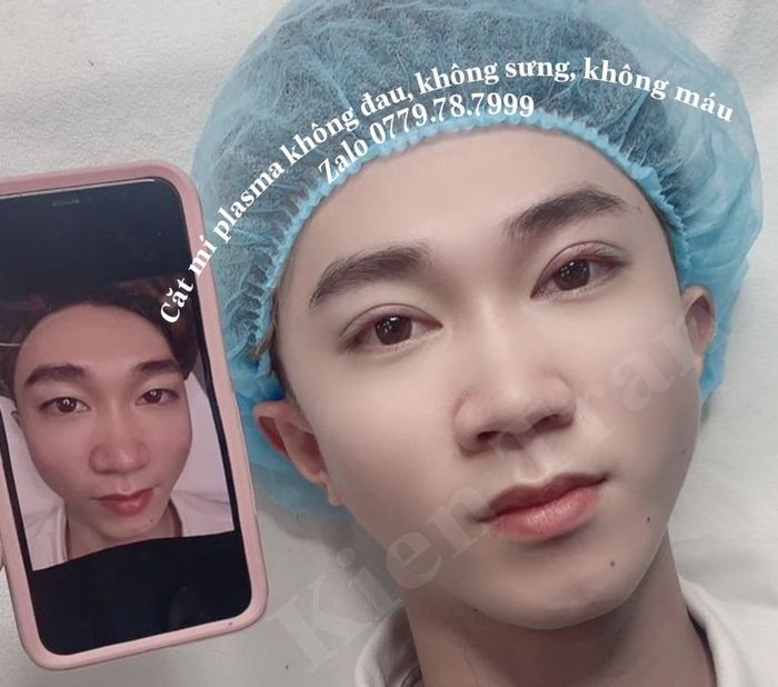 Ảnh Thẩm Mỹ Kiến Trần