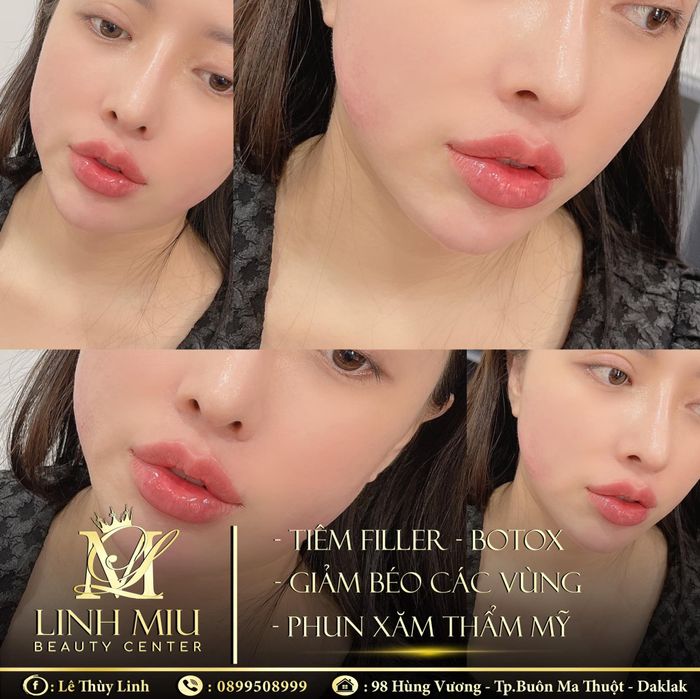 Hình ảnh Linh Miu Beauty 2