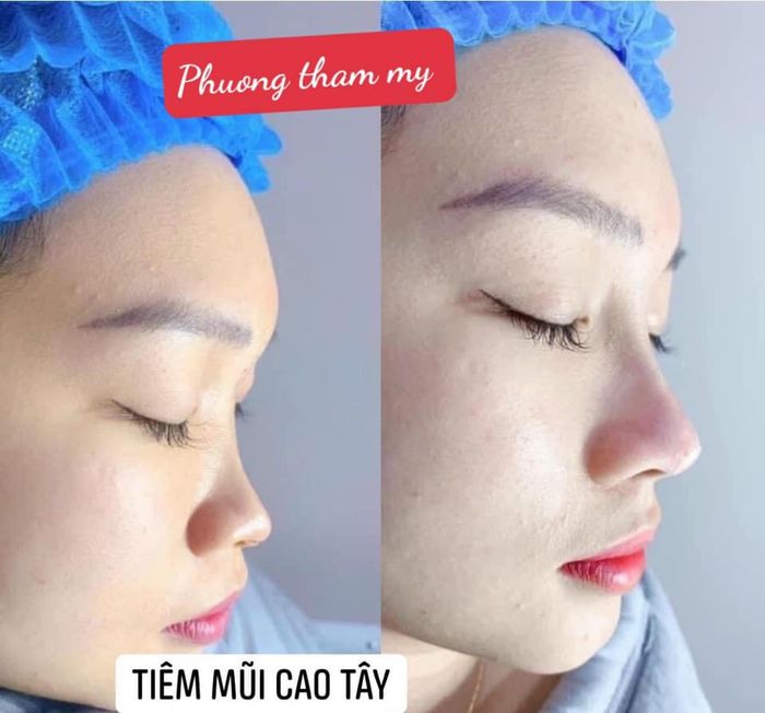 Mỹ Viện Venux Beauty & Clinic hình ảnh 1