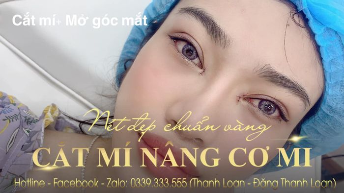 Thanh Loan Beauty Spa & Clinic - Hình 1