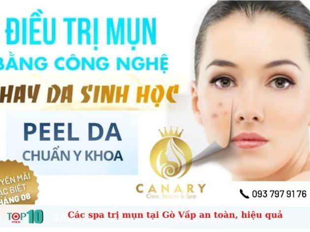 Các spa trị mụn tại Gò Vấp an toàn, hiệu quả