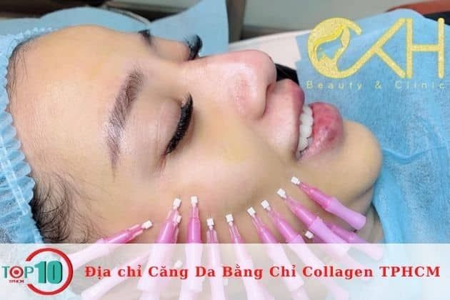 Spa căng da mặt bằng chỉ collagen tại TPHCM | Nguồn: CKH Beauty & Clinic (Chu Khả Hiếu)