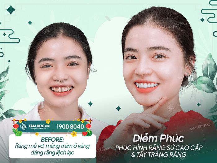 Hình ảnh 1 của Nha Khoa Tâm Đức Smile