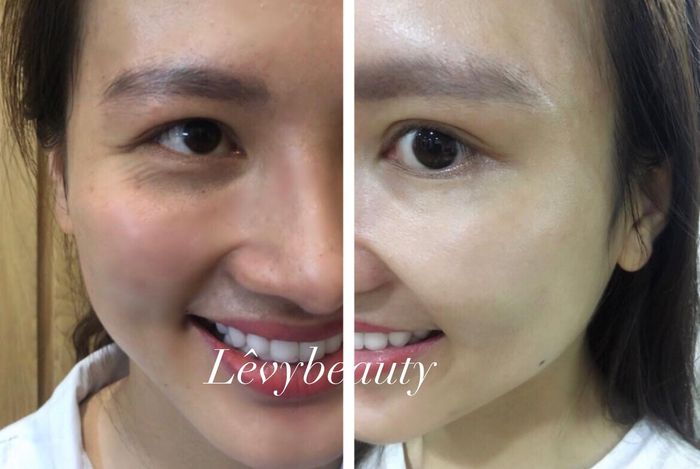 Ảnh 2 tại Lê Vy Beauty Spa