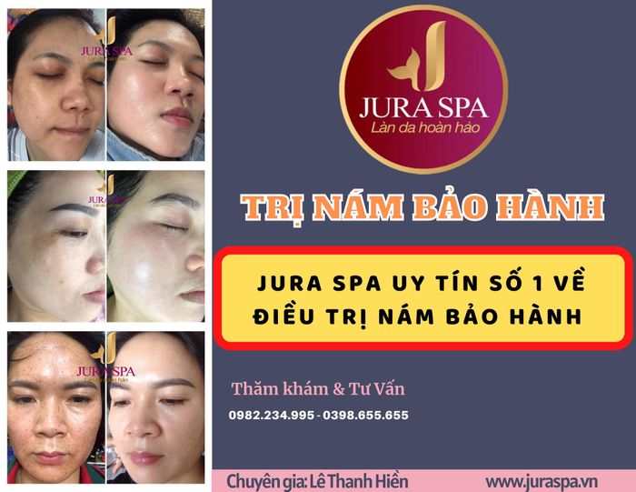 Ảnh 1 của Jura Spa