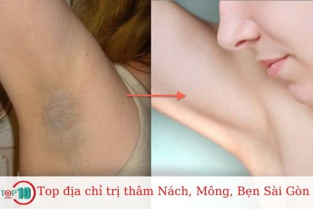 Bệnh viện thẩm mỹ Kangnam Hàn Quốc