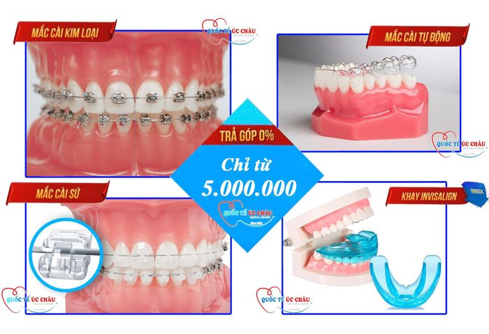 Ảnh 1 của Nha Khoa Quốc Tế Úc Châu