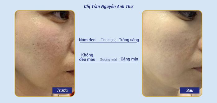 Ảnh 2 tại Thẩm Mỹ Viện Ngọc Dung