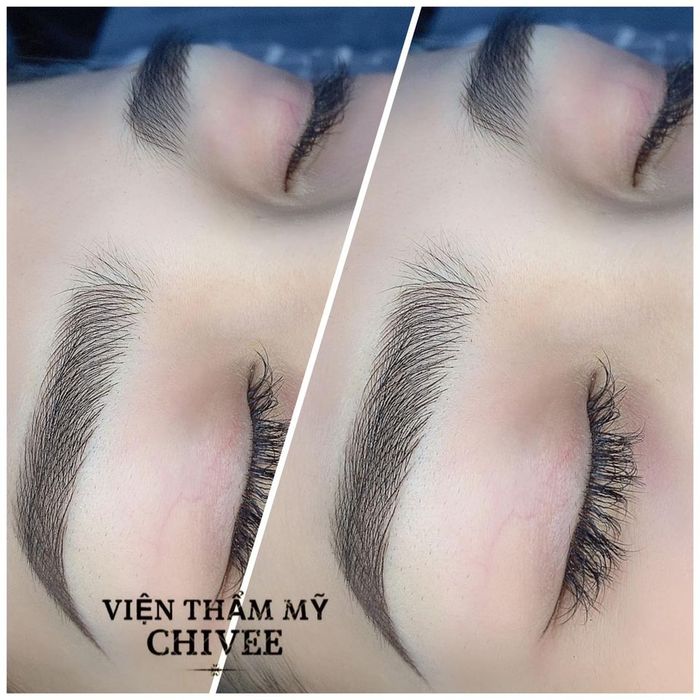 Ảnh 2 của Viện Thẩm Mỹ ChiVee