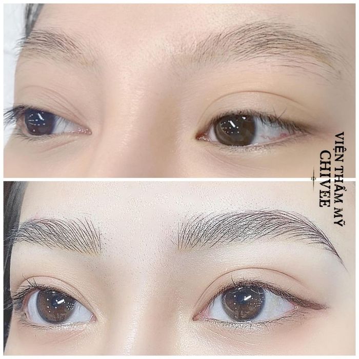 Ảnh 1 của Viện Thẩm Mỹ ChiVee