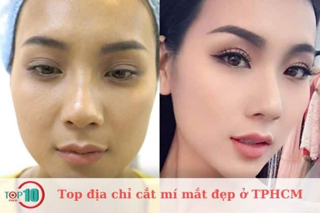 Bệnh viện thẩm mỹ Á Âu