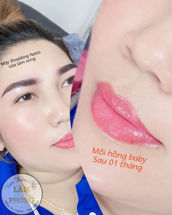 Viện Thẩm Mỹ - Lâm Phong Brows hình ảnh 1