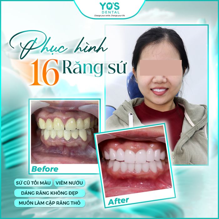 Hình ảnh Nha khoa Sài Gòn Bình Dương 1