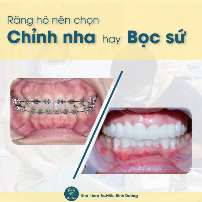Hình ảnh Nha Khoa BS.Hiếu Bình Dương 2