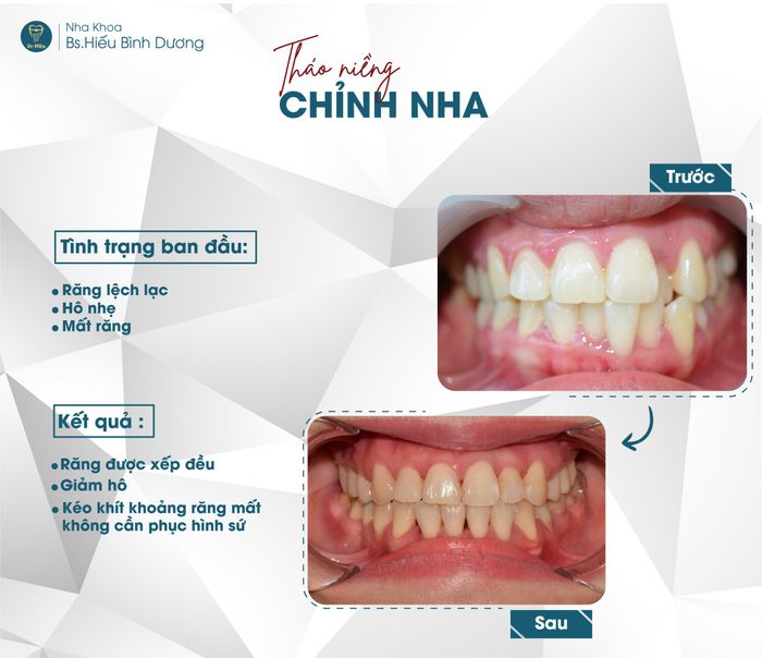 Hình ảnh Nha Khoa BS.Hiếu tại Bình Dương số 1