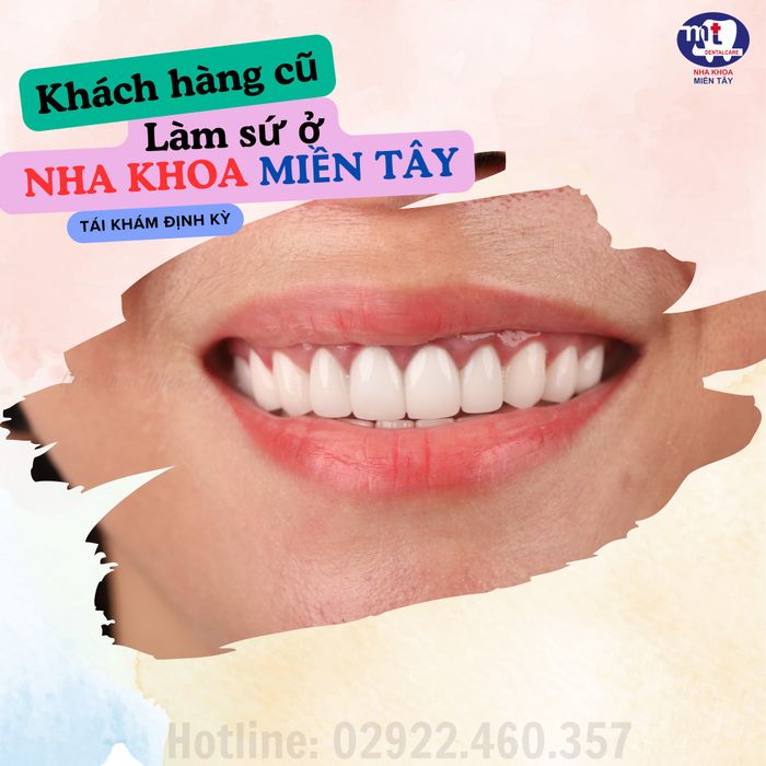 Hình ảnh 2 của Nha Khoa Miền Tây