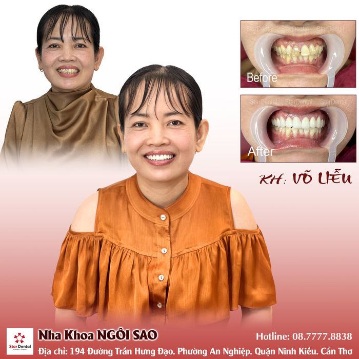 Trung Tâm Răng Miệng Ngôi Sao - Hình ảnh 2