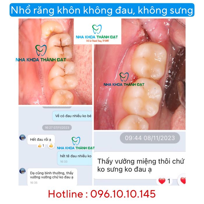 Ảnh Nha Khoa Thành Đạt 2