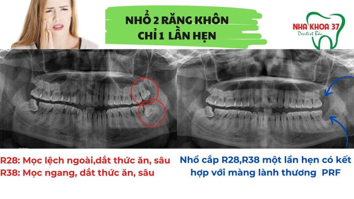 Ảnh của Nha Khoa 37 - 1