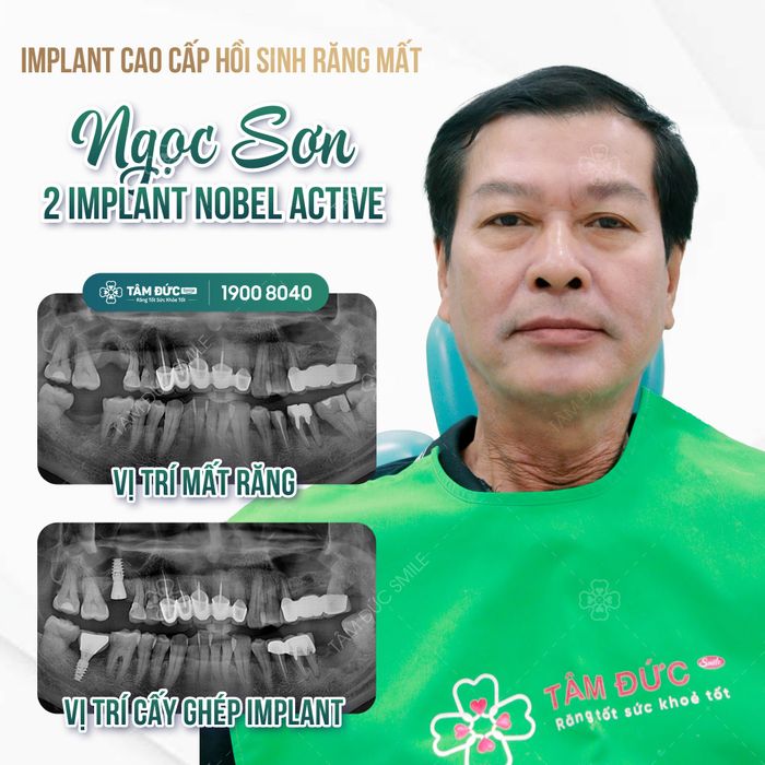 Hình ảnh Viện Cấy Ghép Implant TÂM ĐỨC SMILE