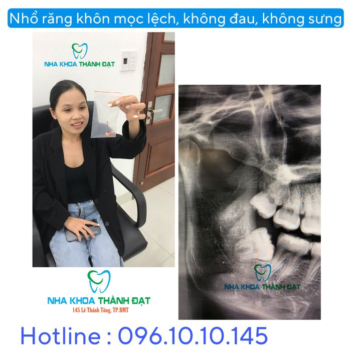 Hình ảnh Spa Ngọc Anh 1