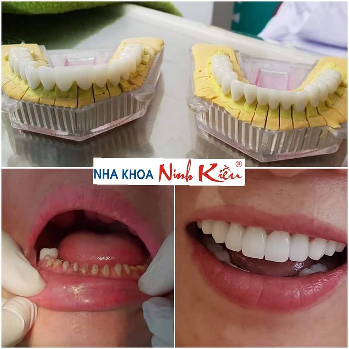 Hình ảnh 2 của Nha Khoa Ninh Kiều