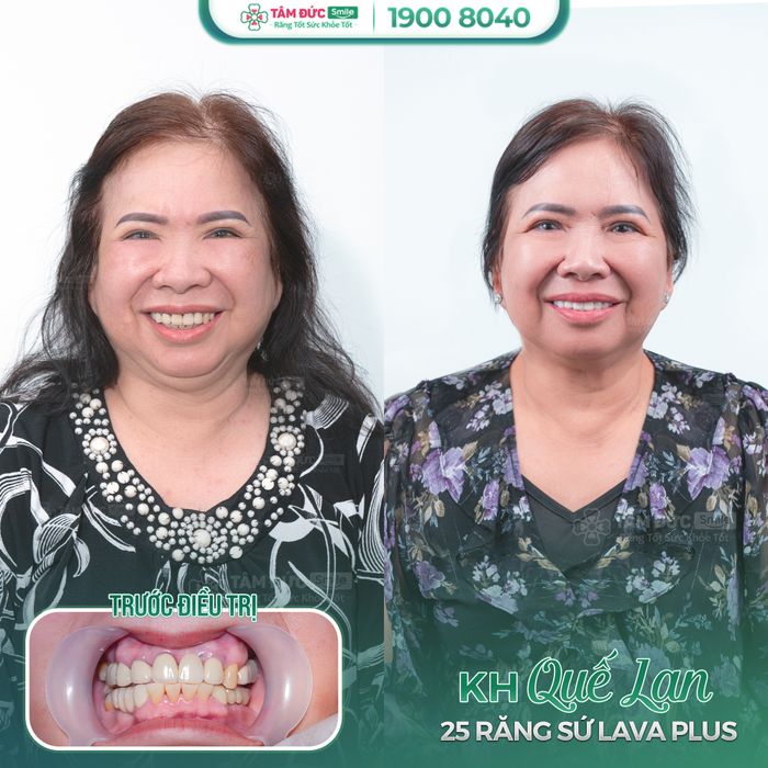 Nha Khoa Tâm Đức Smile - Cần Thơ hình ảnh 2