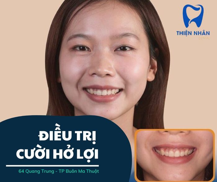 Ảnh Nha Khoa Thiện Nhân 2