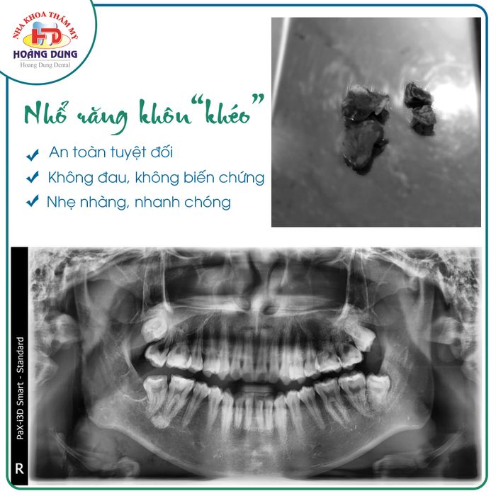 Nha khoa Thẩm mỹ Hoàng Dung hình ảnh 2