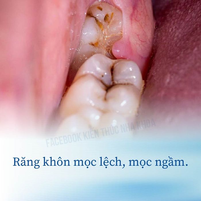 Ảnh Nha Khoa Thiện Nhân 1