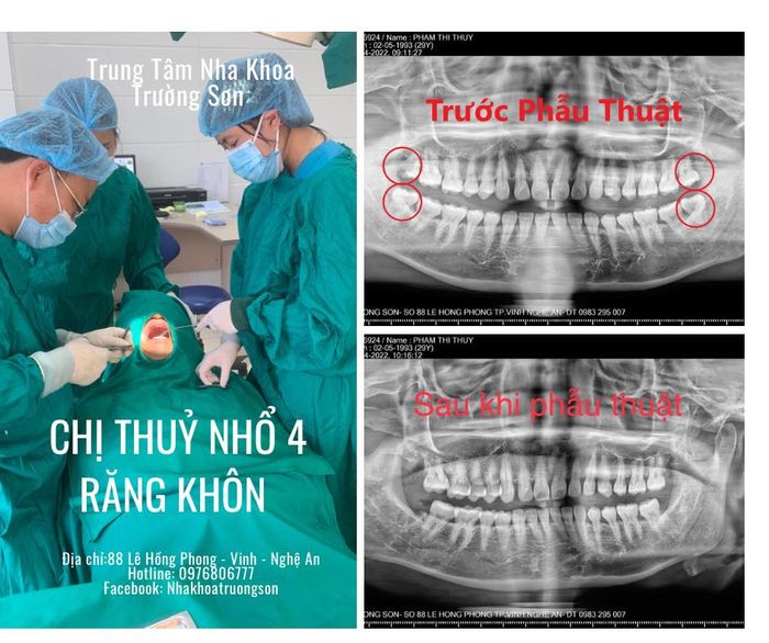 Hình ảnh 1 của Nha Khoa Trường Sơn