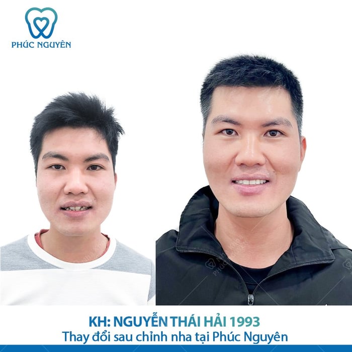 Hình ảnh 1 của Nha khoa Phúc Nguyên