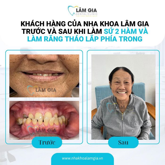 Hình ảnh 2 của Nha Khoa Lâm Gia