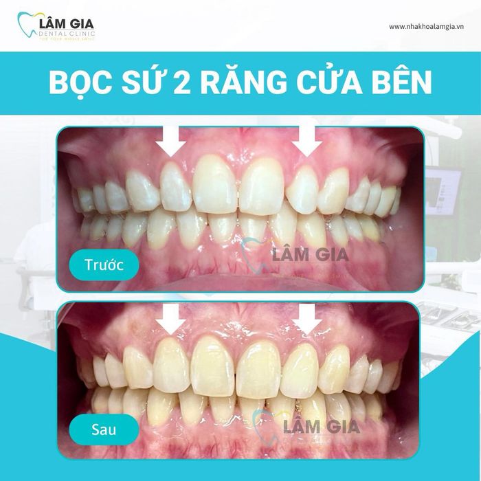 Hình ảnh 1 của Nha Khoa Lâm Gia