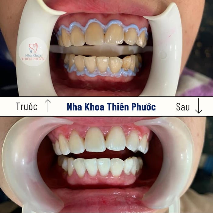 Hình ảnh Nha Khoa Thiên Phước 2