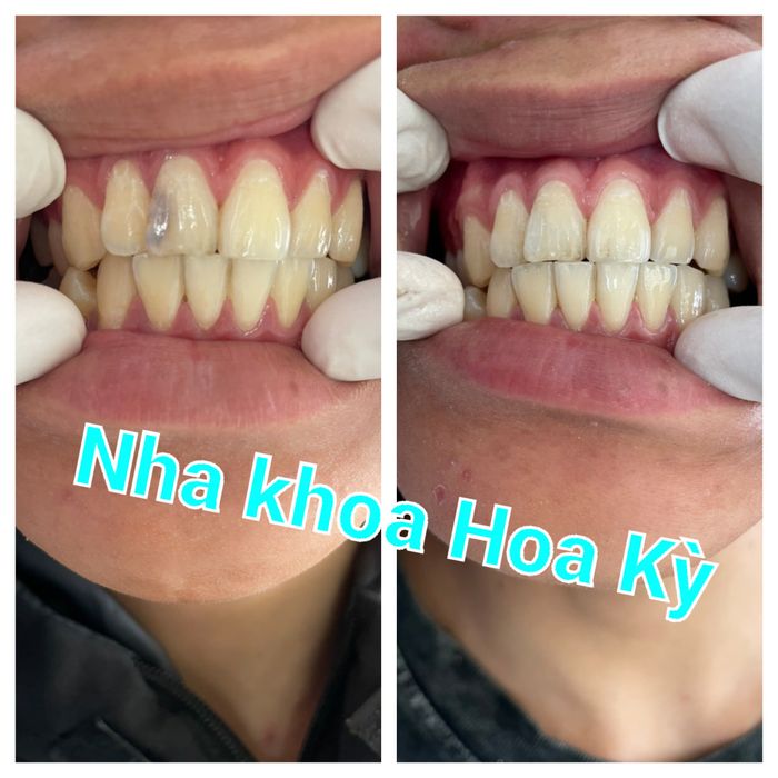 Hình ảnh Nha Khoa Hoa Kỳ 1