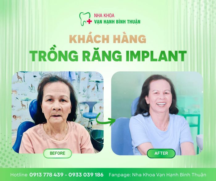 Hình ảnh Nha khoa Vạn Hạnh Bình Thuận 2