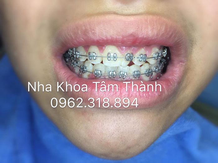 Hình ảnh thứ hai của Nha Khoa Tâm Thành Tuyên Quang