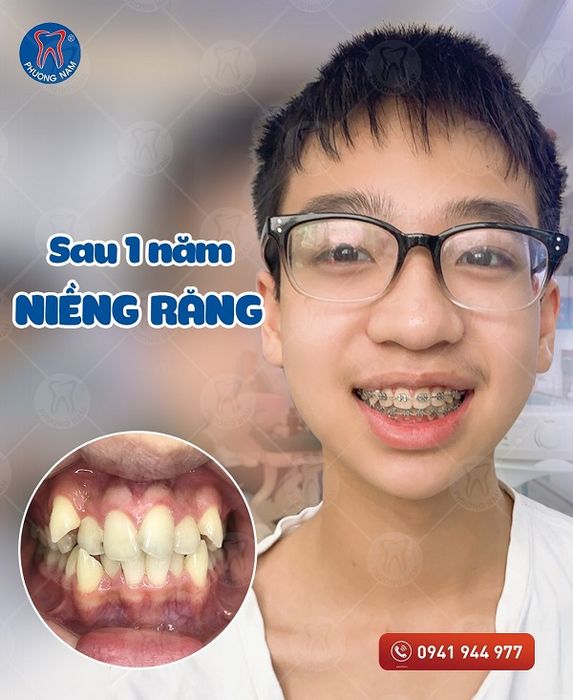 Chi nhánh Tuyên Quang của Nha Khoa Phương Nam - Hình ảnh 2