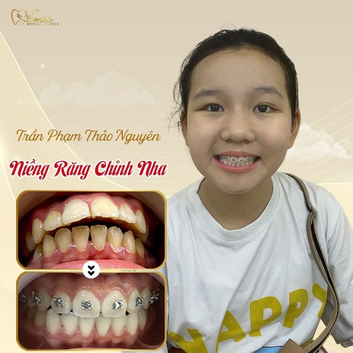 Hình ảnh Nha Khoa Dr.Smile 2