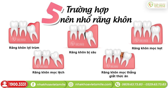 Hình ảnh 2 của Nha khoa Việt Smile