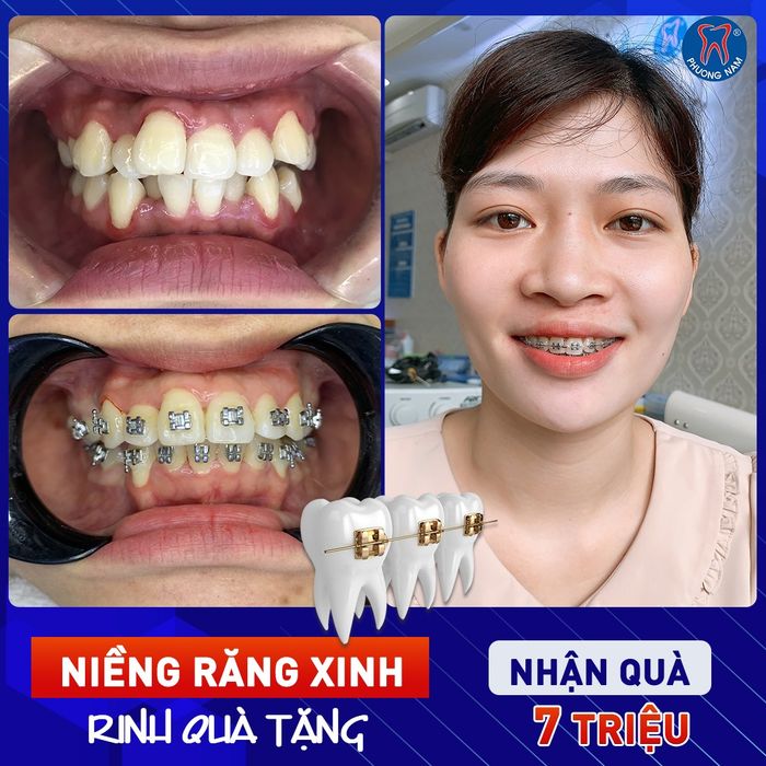 Chi nhánh Tuyên Quang của Nha Khoa Phương Nam - Hình ảnh 1