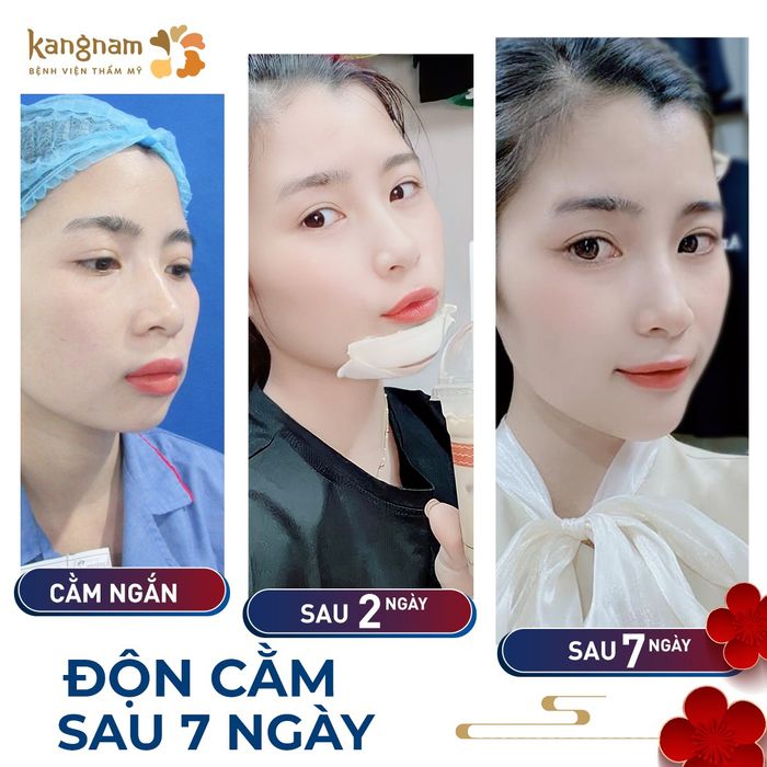 Ảnh của Bệnh viện thẩm mỹ Kangnam 2