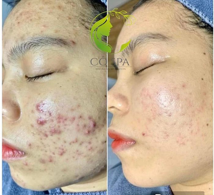 Ảnh 2 tại Cô Beauty Spa