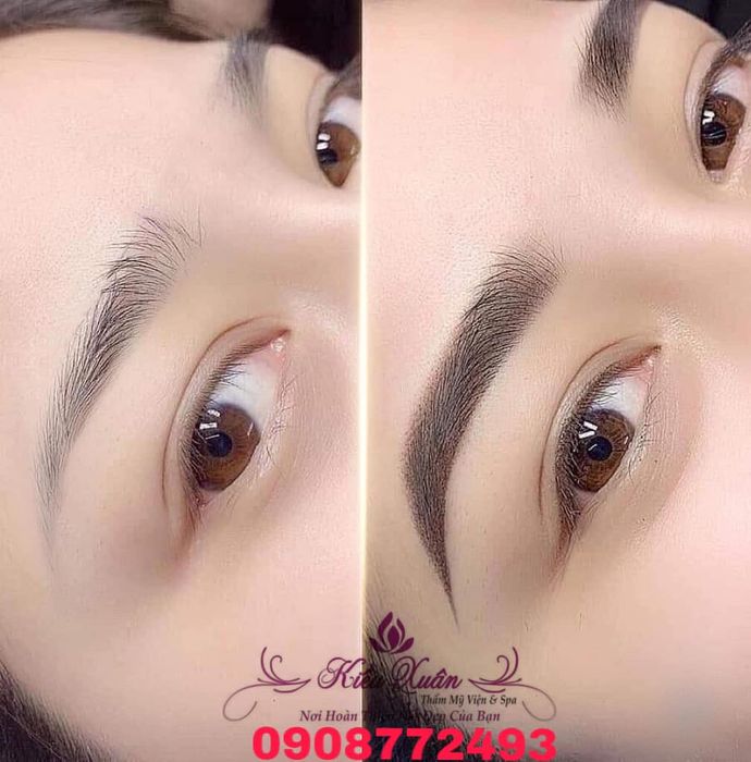 Thẩm mỹ viện KIỀU XUÂN ảnh 2