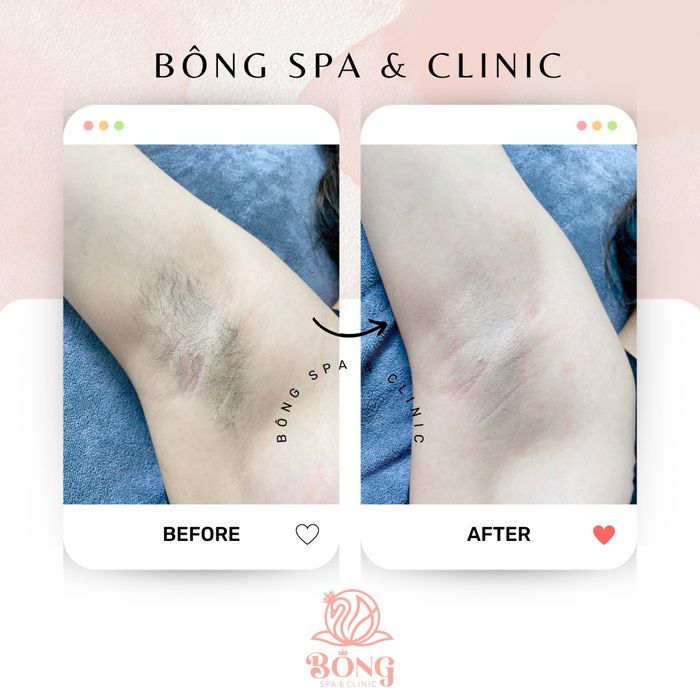 Hình ảnh 1 của Bông Spa - Sắc Đẹp & Sức Khỏe